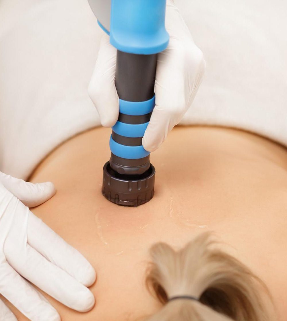 Shockwave Therapy Dunedin